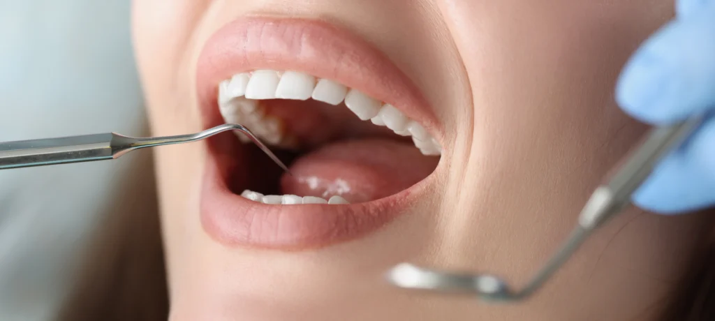 chirurgie orale verneuil sur seine dentiste Dentiste à Verneuil-sur-Seine Chirurgiens-dentistes à Meulan-en-Yvelines