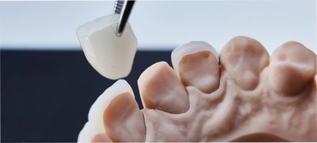 dentiste elisabethville consultation facettes dentaires Dentiste à Elisabethville Chirurgiens-dentistes à Meulan-en-Yvelines