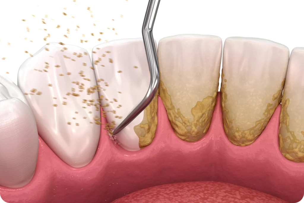 detartage meulan en yvelines Détartrage Chirurgiens-dentistes à Meulan-en-Yvelines