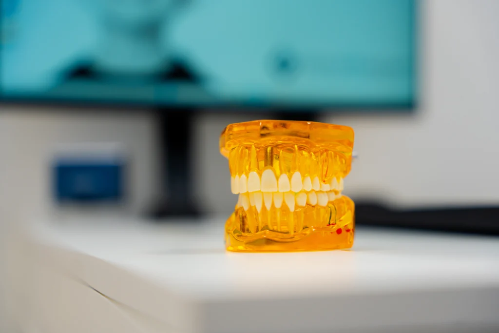 gargenville dentiste implant dentaire Dentiste à Gargenville Chirurgiens-dentistes à Meulan-en-Yvelines