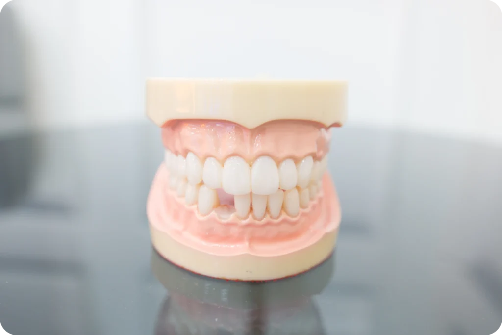 perde dent meulan en yvelines Perte de dent Chirurgiens-dentistes à Meulan-en-Yvelines