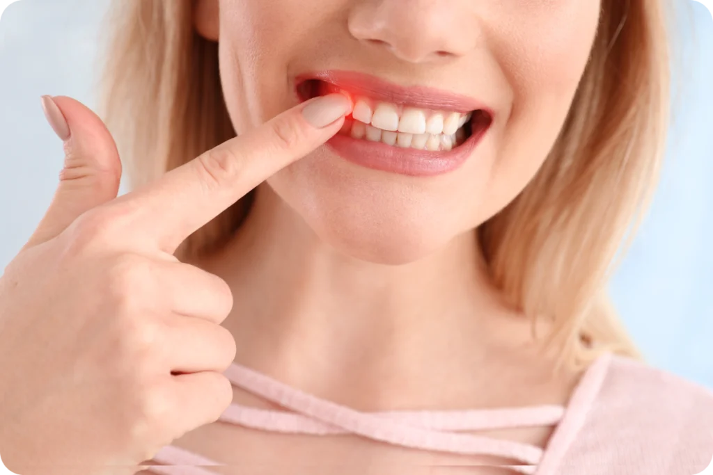 rdv dentiste detartage meulan en yvelines Détartrage Chirurgiens-dentistes à Meulan-en-Yvelines