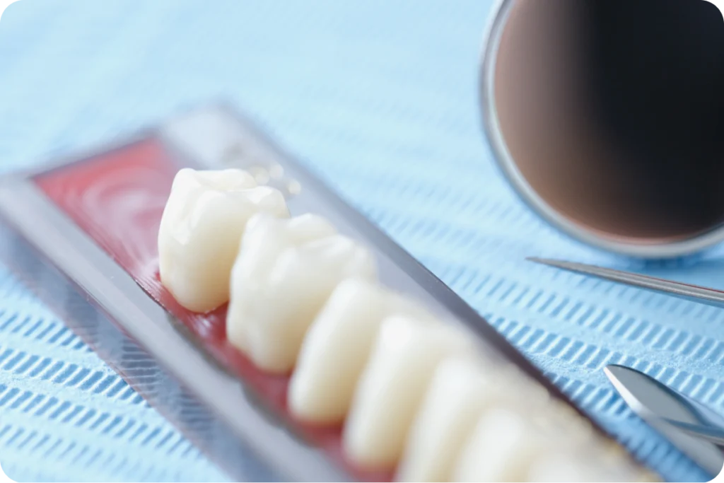 rdv dentiste vernouillet couronne Dentiste à Vernouillet Chirurgiens-dentistes à Meulan-en-Yvelines